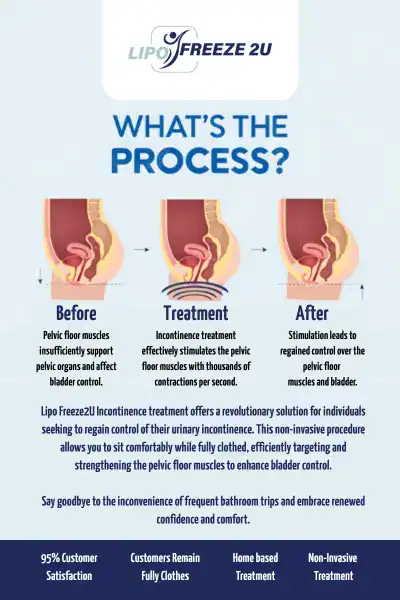 Diagram of how incontinence treatment Chelmsford works.