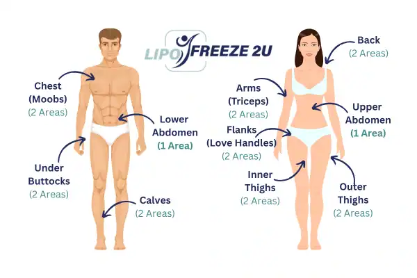 Areas you can have fat freezing treatment Chelmsford