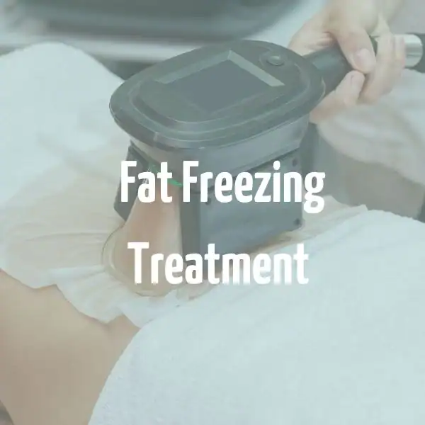 fat freezing treatment Chelmsford