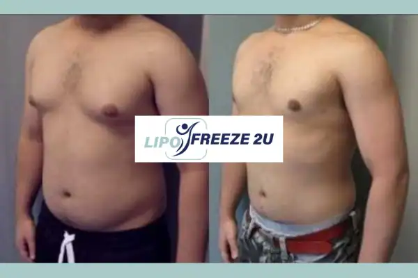 How Long Does It Take to See Results Chelmsford?