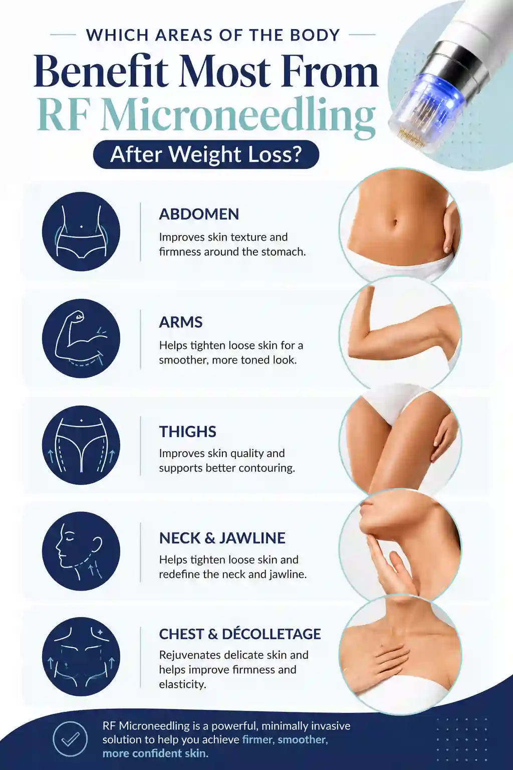 Which Areas of the Body Benefit Most From RF Microneedling After Weight Loss Chelmsford