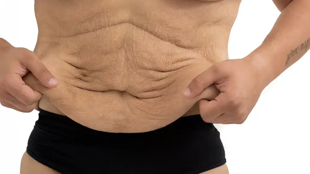 RF Microneedling for Loose Skin: How Can It Help Tighten and Reshape the Skin Chelmsford?